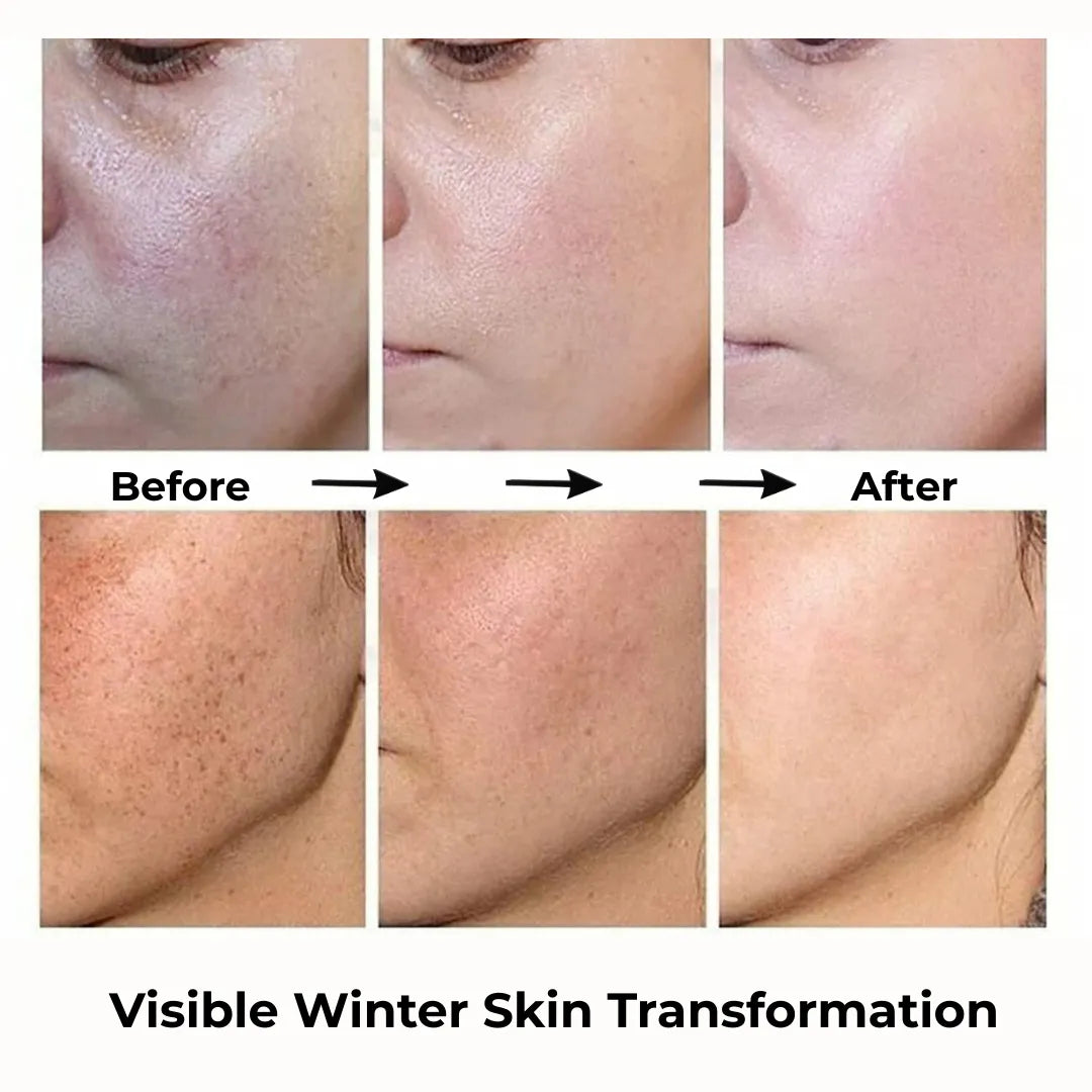 Winter Skin Essentials