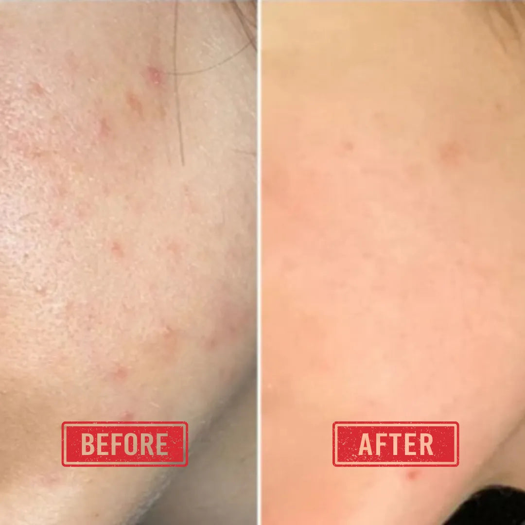 Before and after results showing improvement in skin hydration and overall skin smoothness