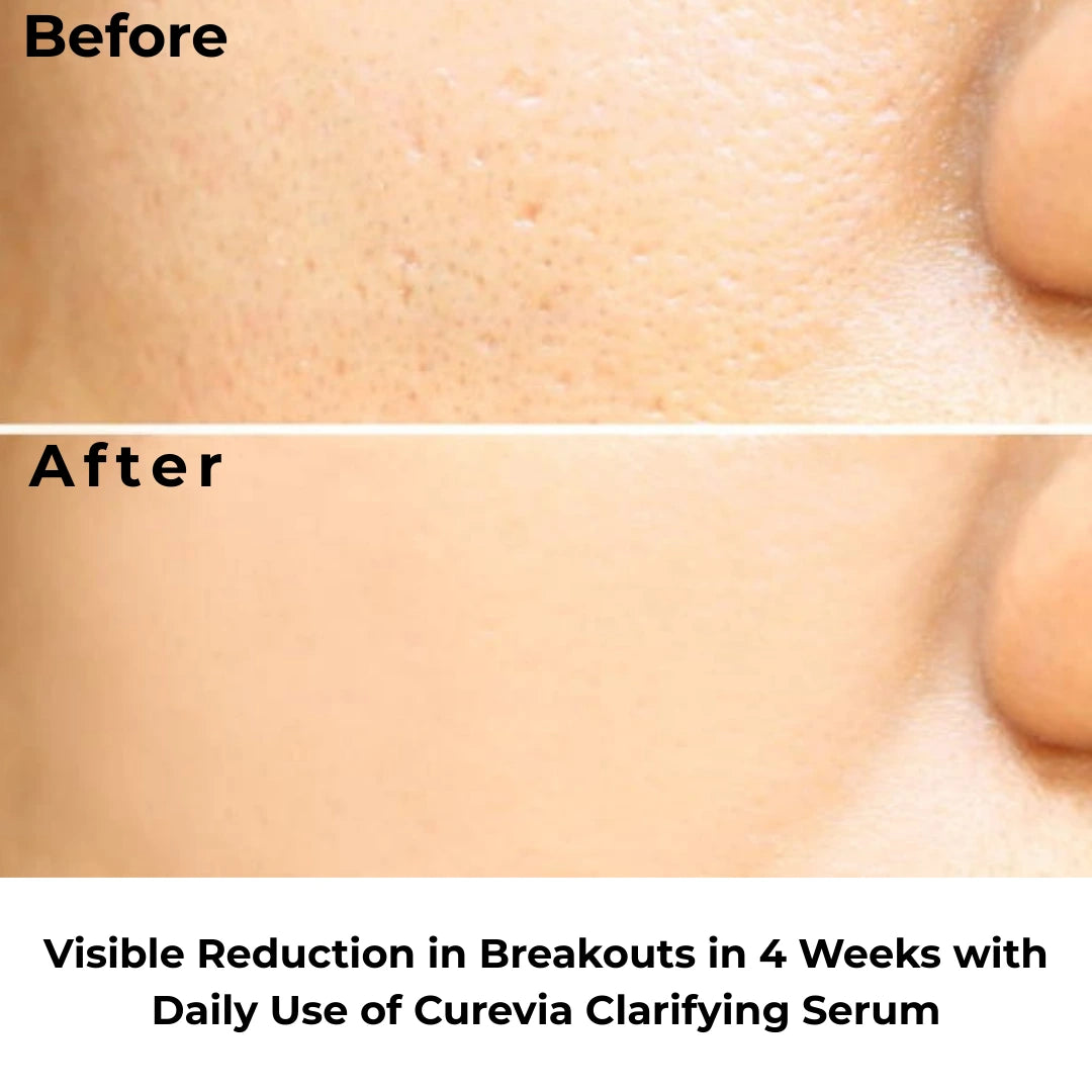 Salicylic Acid 2% Serum