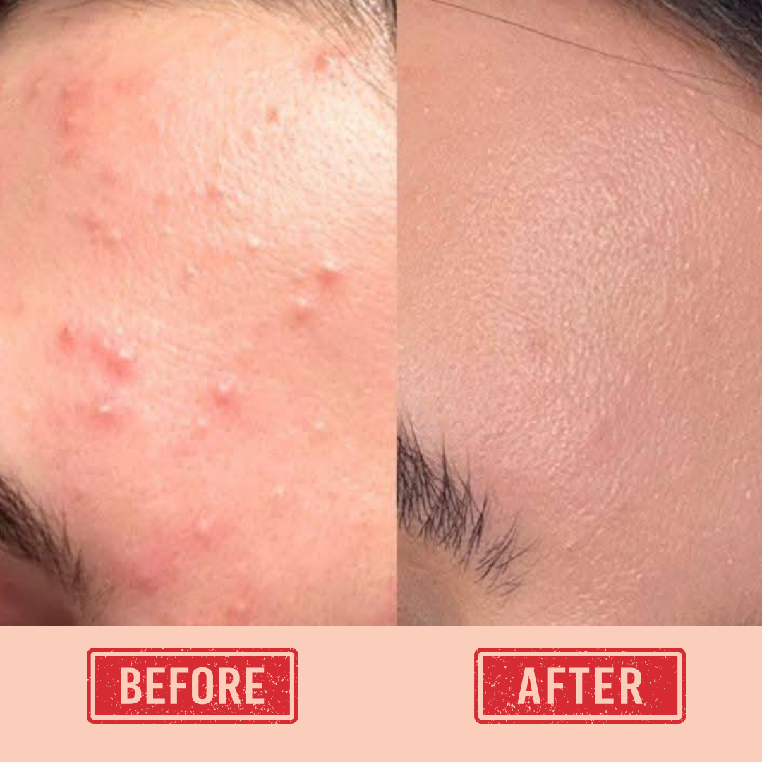 Curevia Daily Routine Bundle